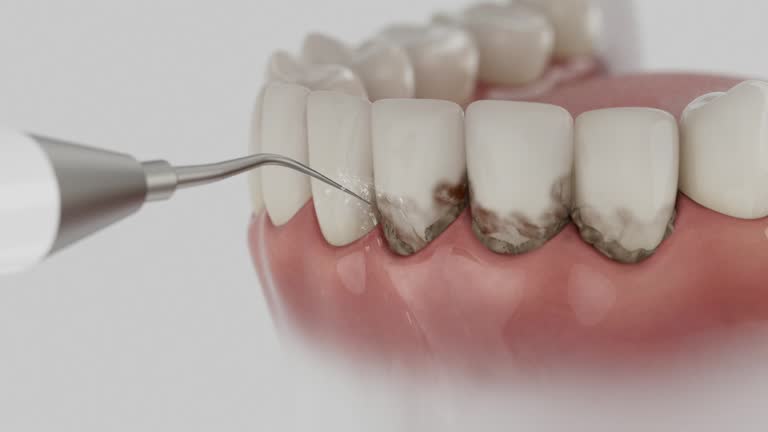 Reliable Dental Implants contractor in Sebree, KY by Smile Center Dentistry